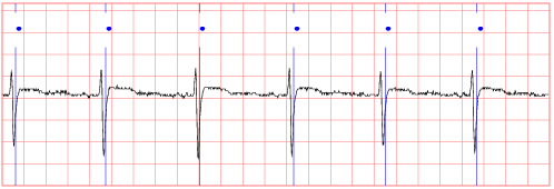 sample waveform