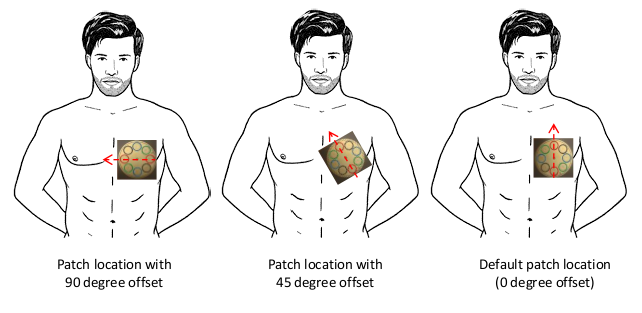 [Position of electrode patch on the body]